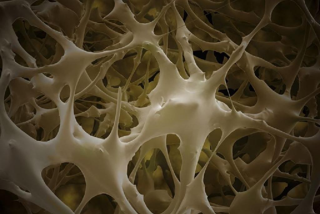 bone